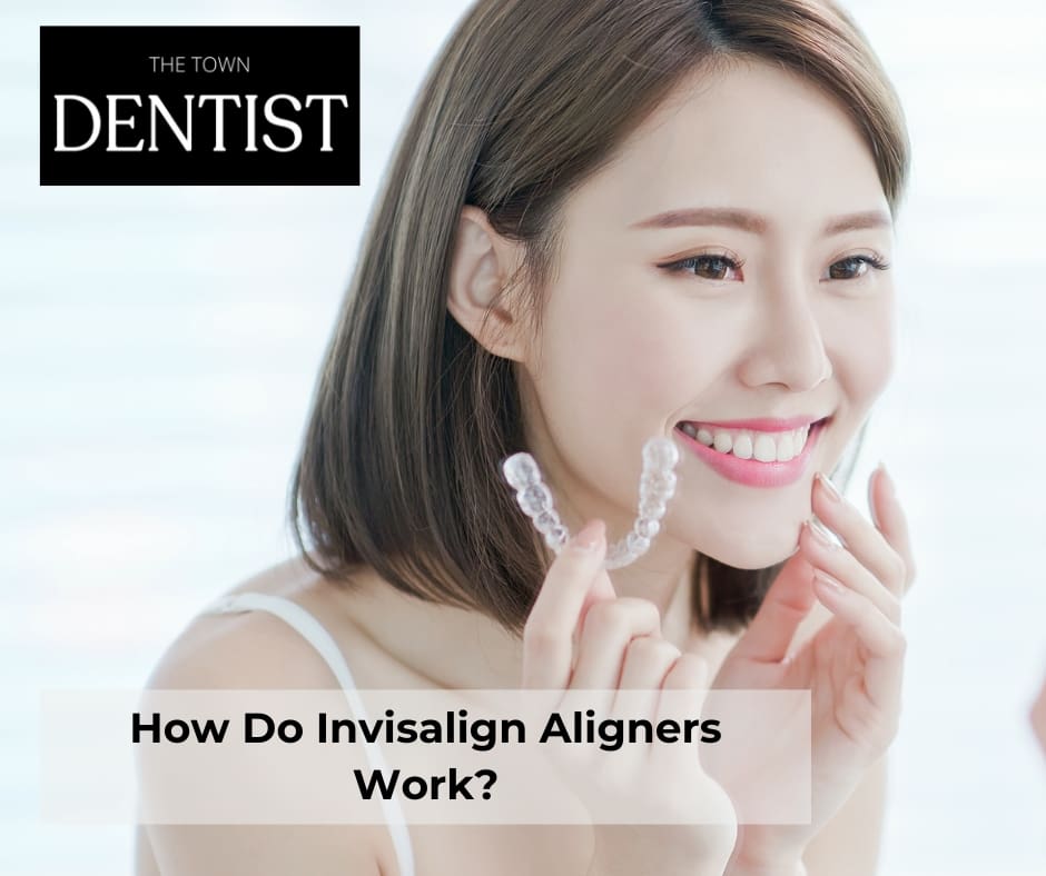 invisalign-aligners