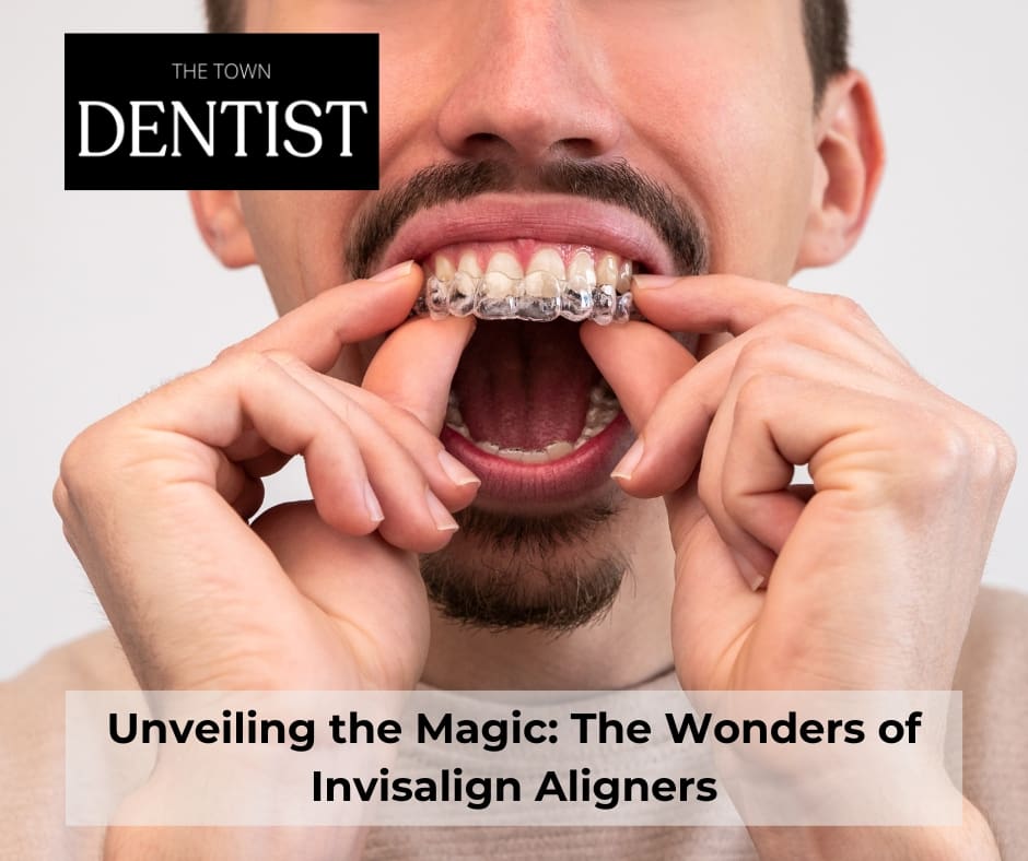 invisalign-aligners